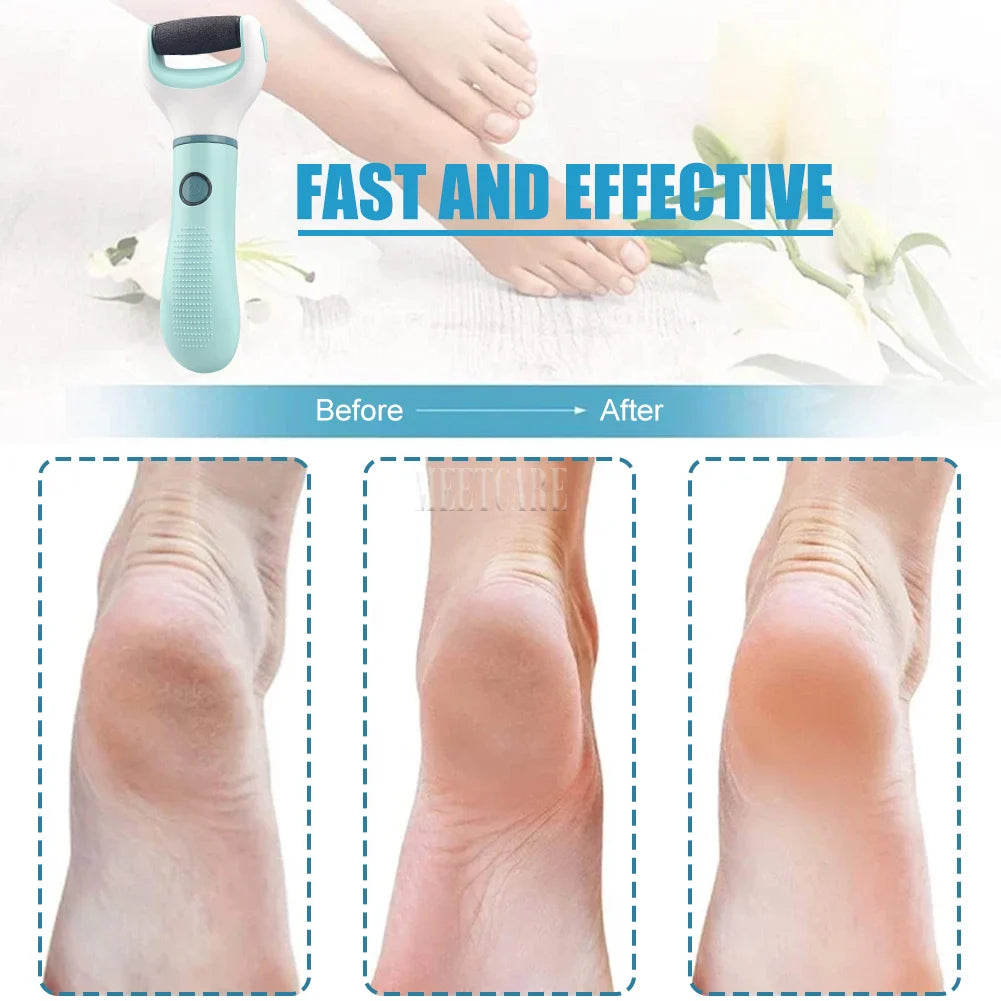 Wireless Electric Foot Grinder